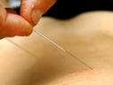Acunputura 01