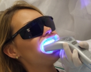 Clareamento A Laser 0