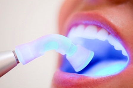 Laser Dental Boca
