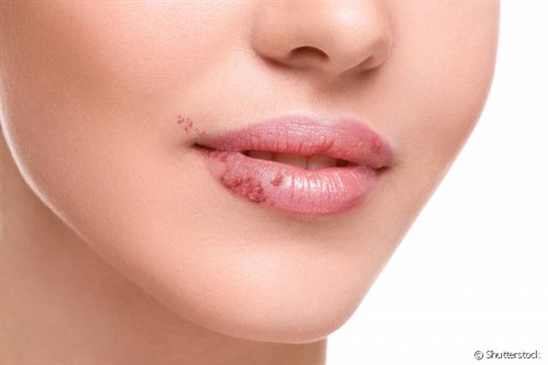 6311-excesso -de -sol -e -alguns -tipos -de -aliment -slider _medias -2