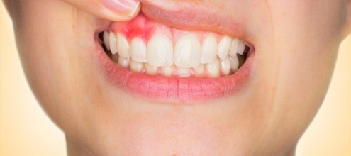 Image 2-12-1170x 520